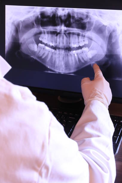 Best Chipped Tooth Repair Near Me  in Northridge, OH